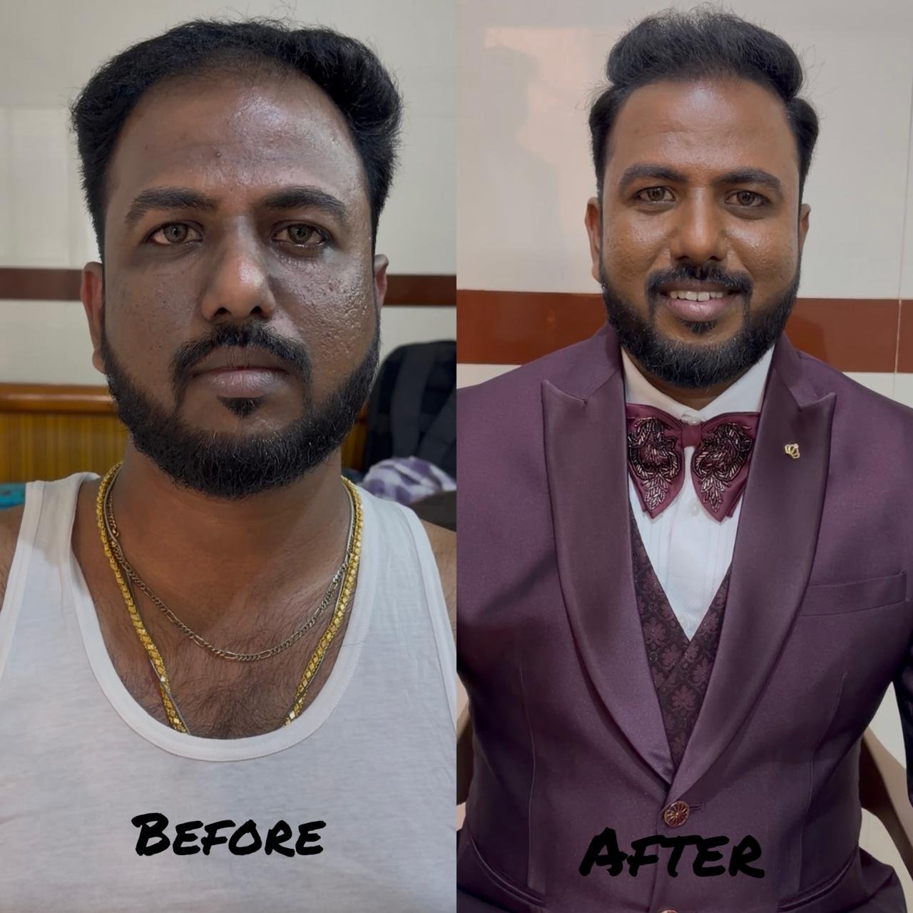 Groom Makeup Before After Chennai